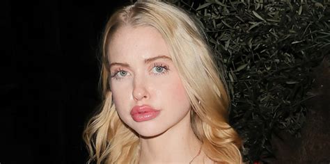 is chloe cherry lips fake|‘Euphoria’ actor Chloe Cherry responds to comments about her lips.